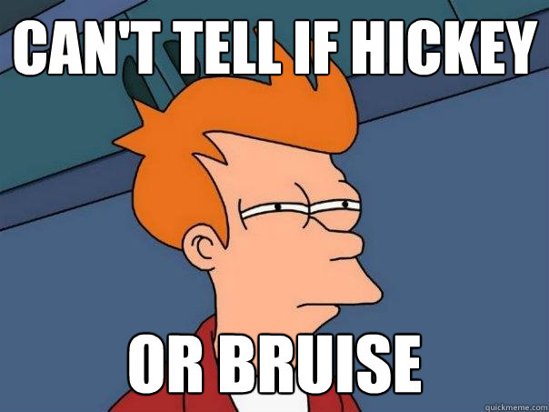 Can't tell if hickey or bruise  Futurama Fry