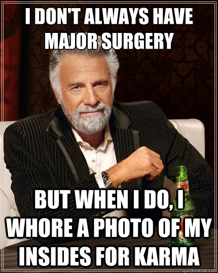 I don't always have major surgery but when I do, I whore a photo of my insides for karma  The Most Interesting Man In The World