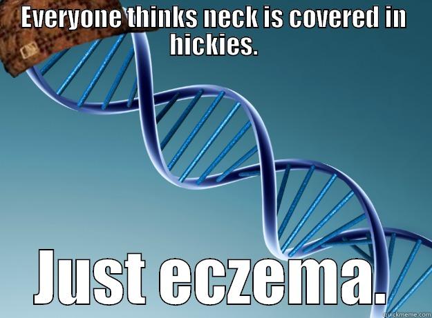 EVERYONE THINKS NECK IS COVERED IN HICKIES. JUST ECZEMA. Scumbag Genetics