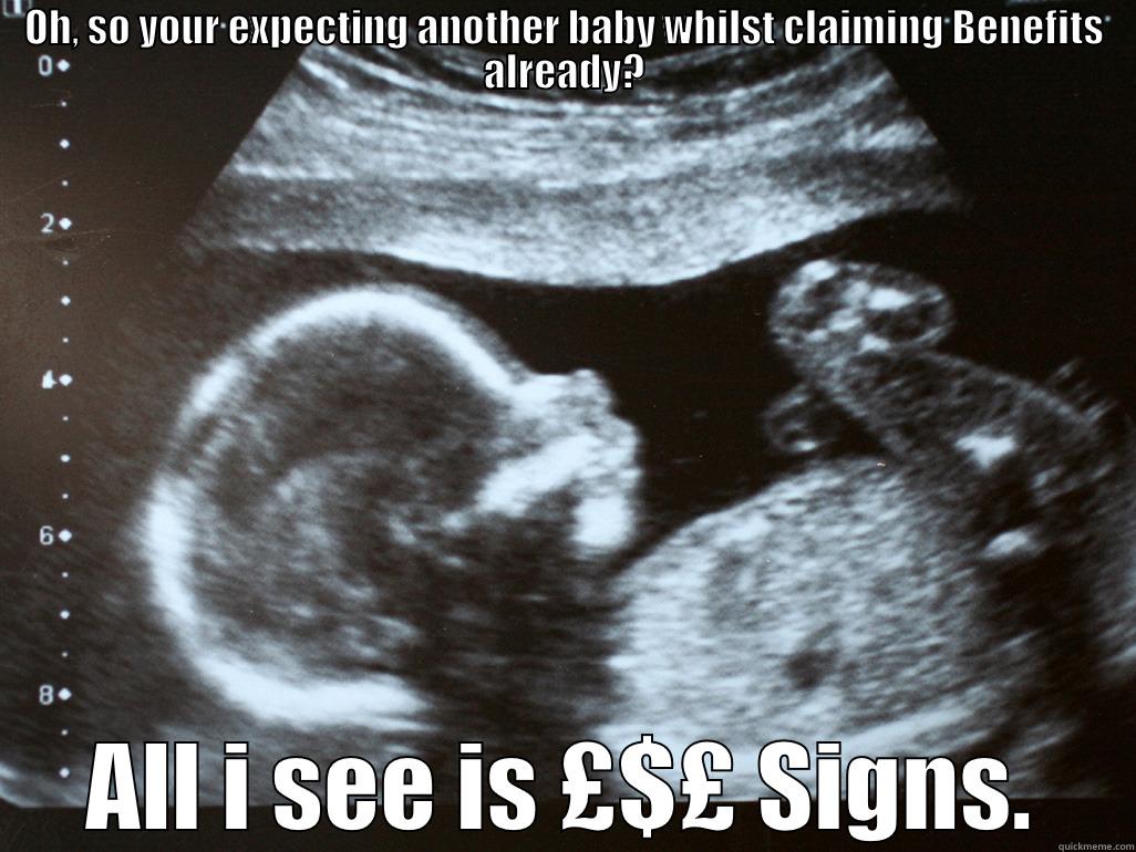 OH, SO YOUR EXPECTING ANOTHER BABY WHILST CLAIMING BENEFITS ALREADY? ALL I SEE IS £$£ SIGNS. Misc