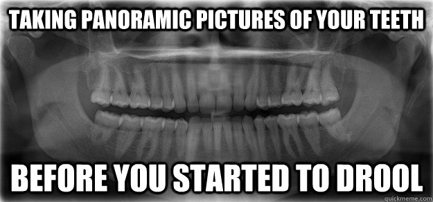 Taking panoramic pictures of your teeth before you started to drool  Hipster Dental Radiography