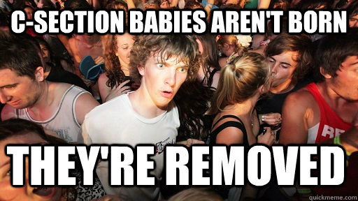 C-section babies aren't born they're removed  Sudden Clarity Clarence