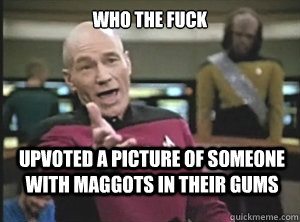 who the fuck upvoted a picture of someone with maggots in their gums  Annoyed Picard