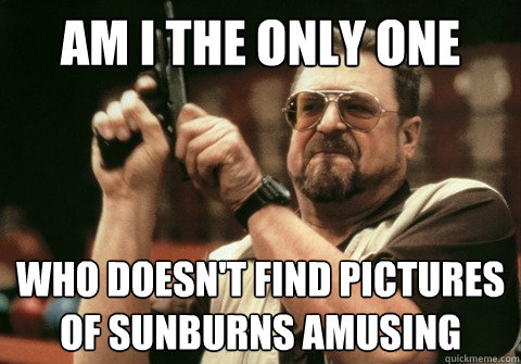 Am I the only one Who doesn't find pictures of sunburns amusing - Am I the only one Who doesn't find pictures of sunburns amusing  Am I the only one