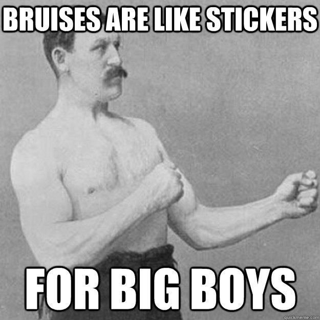 Bruises are like stickers for big boys - Bruises are like stickers for big boys  overly manly man