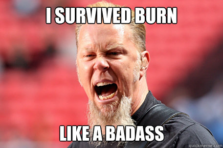 I survived burn  like a badass   I AM THE TABLE - James Hetfield