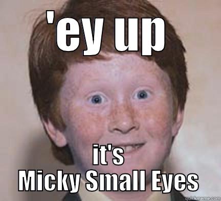 'EY UP IT'S MICKY SMALL EYES Over Confident Ginger