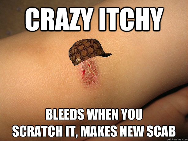 CRAZY ITCHY BLEEDS WHEN YOU 
SCRATCH IT, MAKES NEW SCAB - CRAZY ITCHY BLEEDS WHEN YOU 
SCRATCH IT, MAKES NEW SCAB  Scumbag Scab