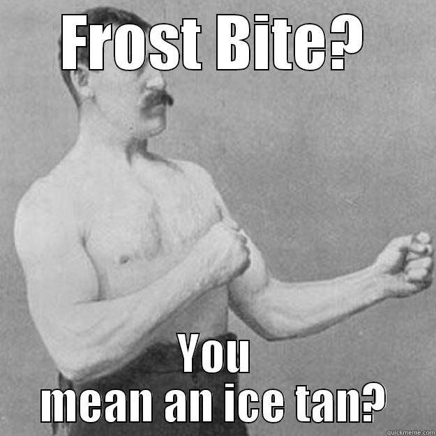 FROST BITE? YOU MEAN AN ICE TAN? overly manly man