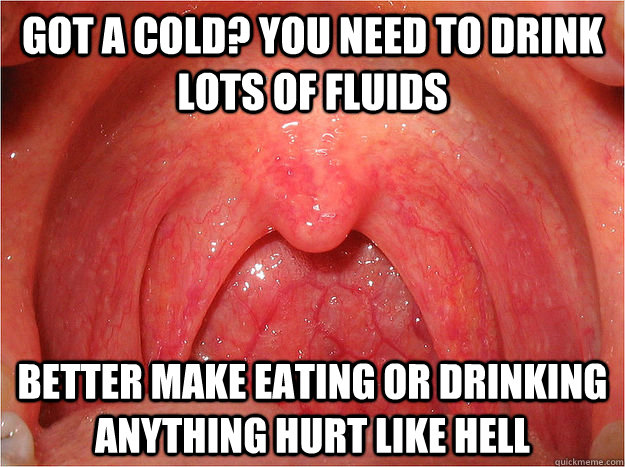 Got a cold? You need to drink lots of fluids Better make eating or drinking anything hurt like hell - Got a cold? You need to drink lots of fluids Better make eating or drinking anything hurt like hell  Scumbag Sore Throat