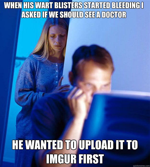 When his wart blisters started bleeding i asked if we should see a doctor He wanted to upload it to imgur first  Redditors Wife