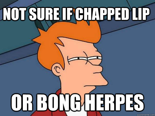 not sure if chapped lip or bong herpes  Futurama Fry