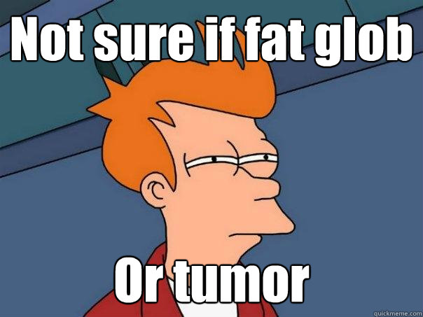 Not sure if fat glob Or tumor   Futurama Fry