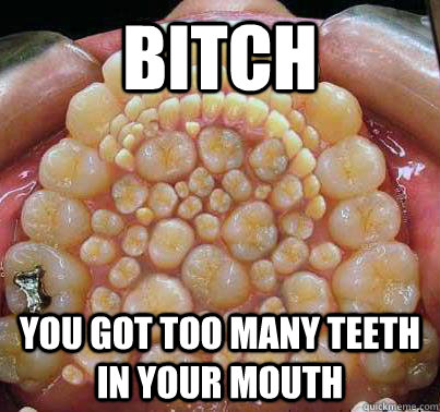 BITCH you got too many teeth in your mouth  