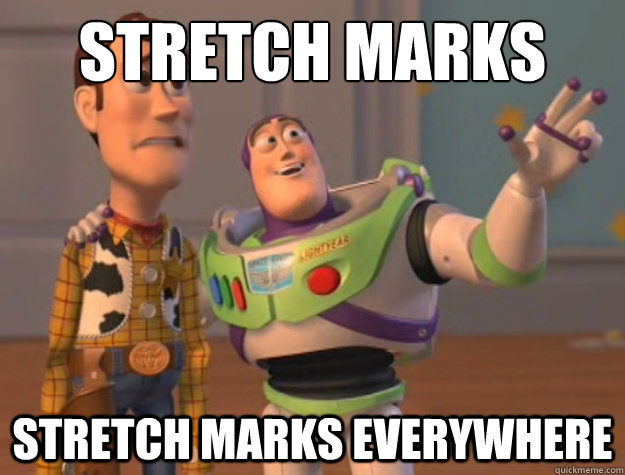 Stretch Marks Stretch marks everywhere - Stretch Marks Stretch marks everywhere  Buzz Lightyear