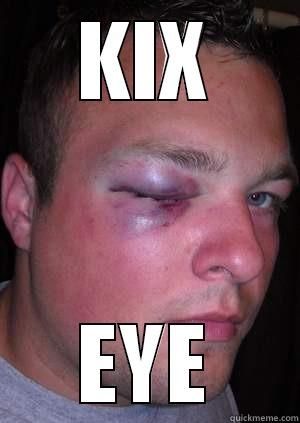KIX EYE Misc
