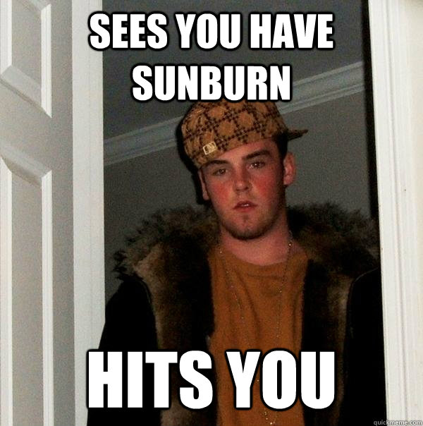 Sees you have sunburn hits you  Scumbag Steve