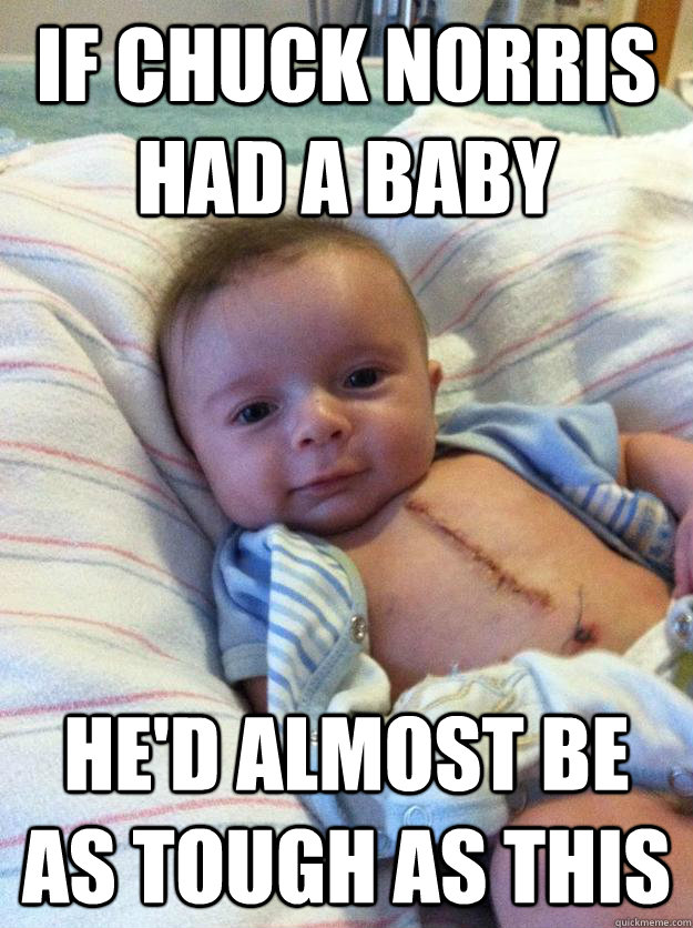 If Chuck Norris Had A Baby He'd Almost Be As Tough As This  Ridiculously Goodlooking Surgery Baby