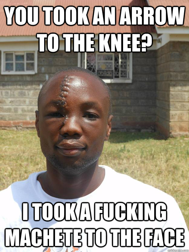 You took an arrow to the knee? I took a fucking machete to the face  Omari