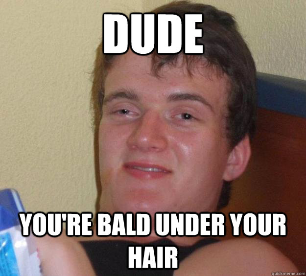 dude you're bald under your hair - dude you're bald under your hair  10 Guy