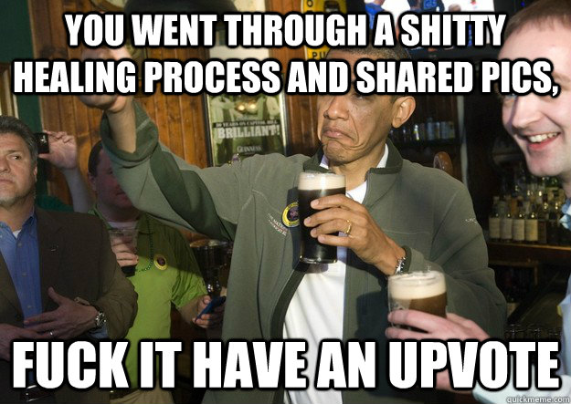 You went through a shitty healing process and shared pics, Fuck It Have an Upvote - You went through a shitty healing process and shared pics, Fuck It Have an Upvote  BARACK OBAMA APPROVES