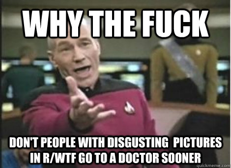 Why the fuck Don't people with disgusting  pictures in r/wtf go to a doctor sooner - Why the fuck Don't people with disgusting  pictures in r/wtf go to a doctor sooner  Misc