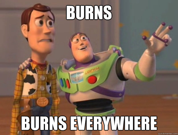 Burns burns everywhere  