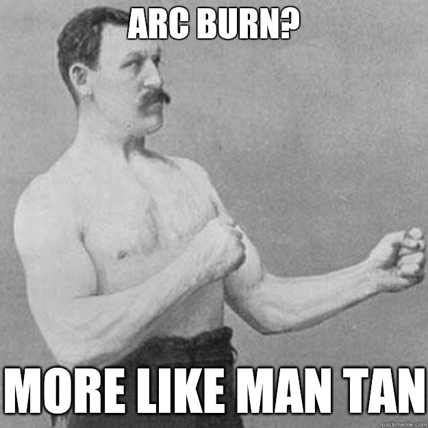 Arc burn?  More like man tan  overly manly man