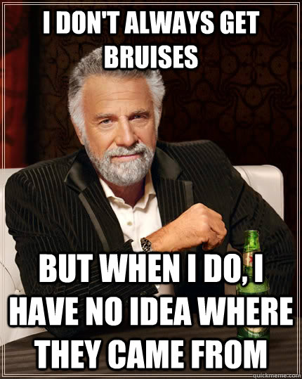 I don't always get bruises but when i do, i have no idea where they came from  The Most Interesting Man In The World