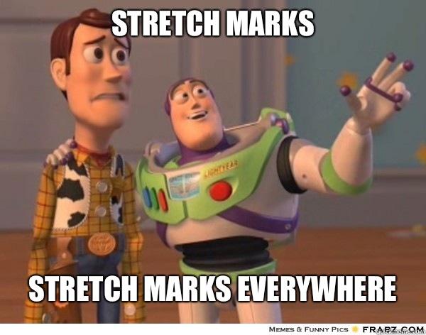 Stretch Marks Stretch Marks Everywhere  Buzzlightyear