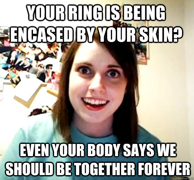 Your ring is being encased by your skin? even your body says we should be together forever - Your ring is being encased by your skin? even your body says we should be together forever  Misc