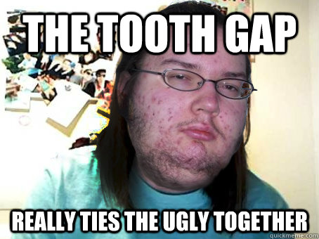 The tooth gap Really ties the ugly together - The tooth gap Really ties the ugly together  Misc
