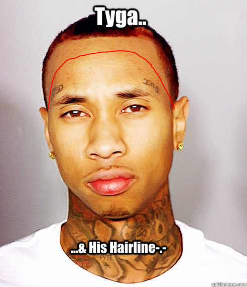 Tyga.. ...& His Hairline-.- - Tyga.. ...& His Hairline-.-  TygaHairline