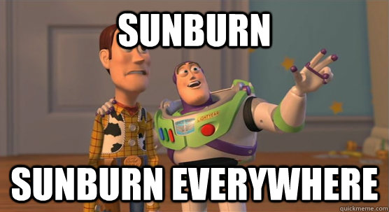 Sunburn sunburn everywhere  Toy Story Everywhere