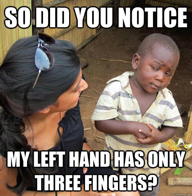 So did you notice my left hand has only three fingers? - So did you notice my left hand has only three fingers?  Skeptical Third World Kid