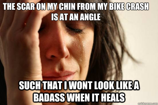 The Scar on my chin from my bike crash is at an angle such that I wont look like a badass when it heals  First World Problems