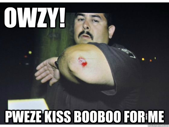 OWZY! PWEZE KISS BOOBOO FOR ME  