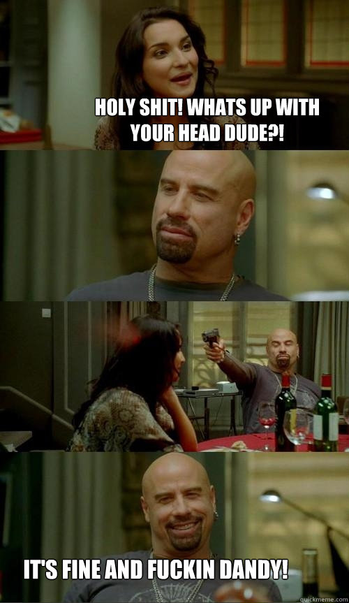 Holy shit! Whats up with your head dude?! it's Fine and fuckin dandy!  Skinhead John