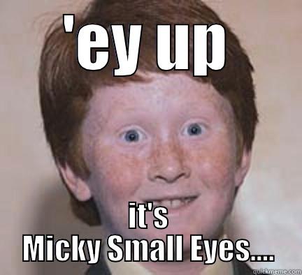 'EY UP IT'S MICKY SMALL EYES.... Over Confident Ginger