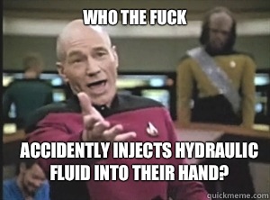 who the fuck Accidently injects hydraulic fluid into their hand?  Annoyed Picard