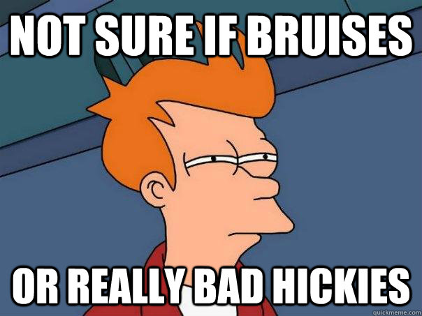 Not sure if bruises or really bad hickies  Futurama Fry