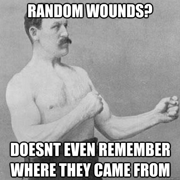 random wounds? doesnt even remember where they came from  overly manly man
