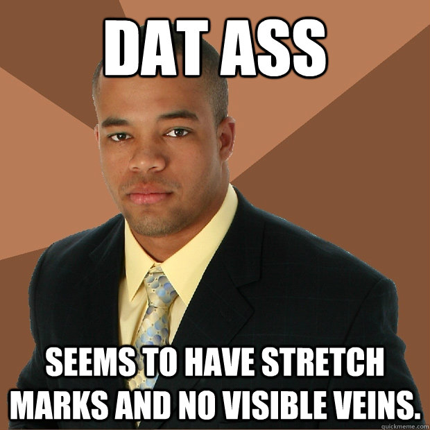 DAT ASS Seems to have stretch marks and no visible veins.  Successful Black Man