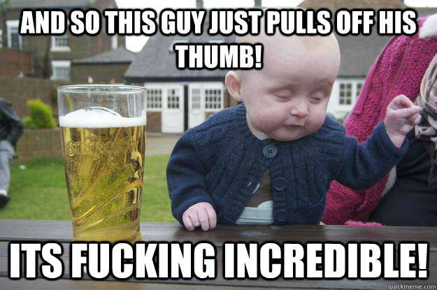 And so this guy just pulls off his thumb! Its fucking incredible! - And so this guy just pulls off his thumb! Its fucking incredible!  drunk baby