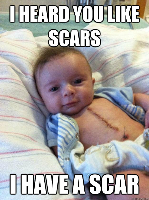 I heard you like scars I have a scar  Ridiculously Goodlooking Surgery Baby