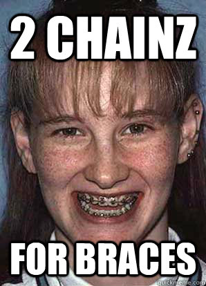 2 CHAINZ FOR BRACES - 2 CHAINZ FOR BRACES  2 chainz