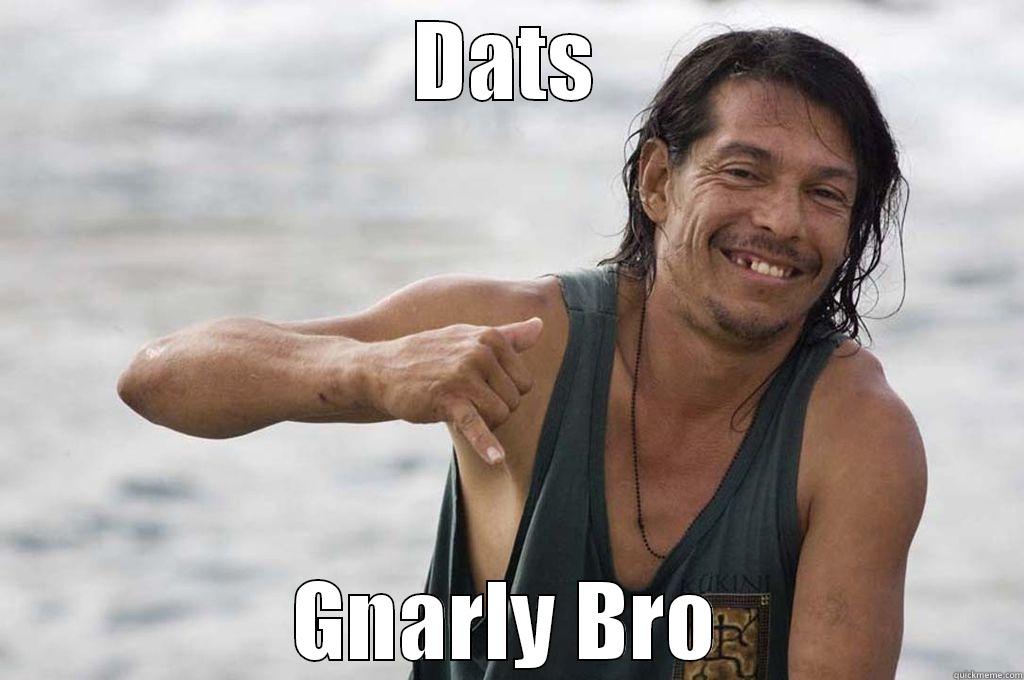 Dat's Gnarly Bro - DATS GNARLY BRO Misc