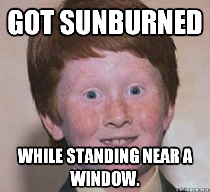 Got sunburned while standing near a window. - Got sunburned while standing near a window.  Over Confident Ginger