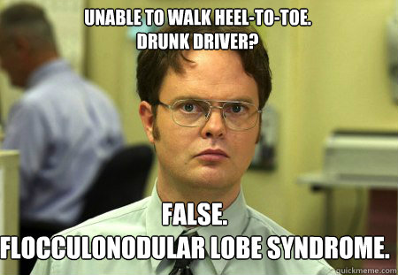 Unable to walk heel-to-toe.
Drunk driver? False.
Flocculonodular lobe syndrome.  Schrute