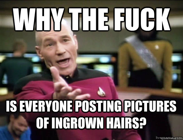why the fuck is everyone posting pictures of ingrown hairs?  Annoyed Picard HD